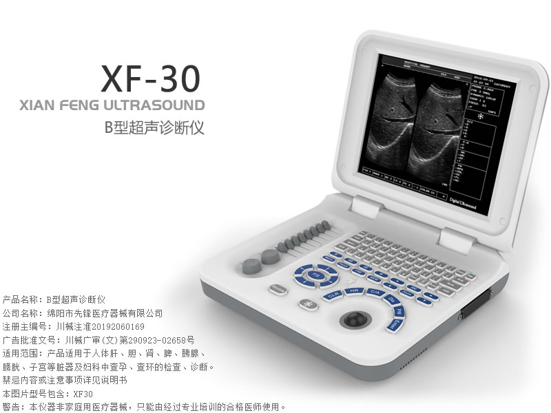 B型超声诊断仪
