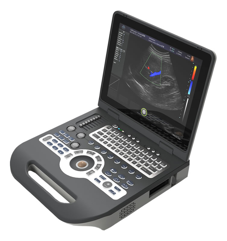 XF-3800色彩多普勒超声诊断仪