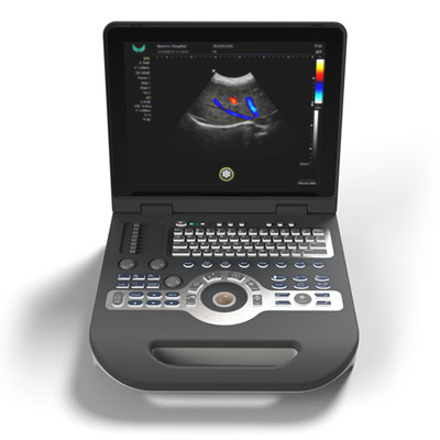 XF-3600-彩色多普勒超声诊断仪